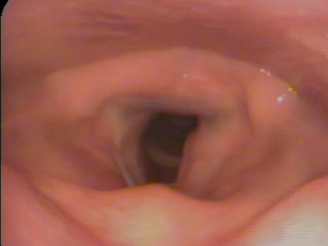 5.10.18 - 2.2 top